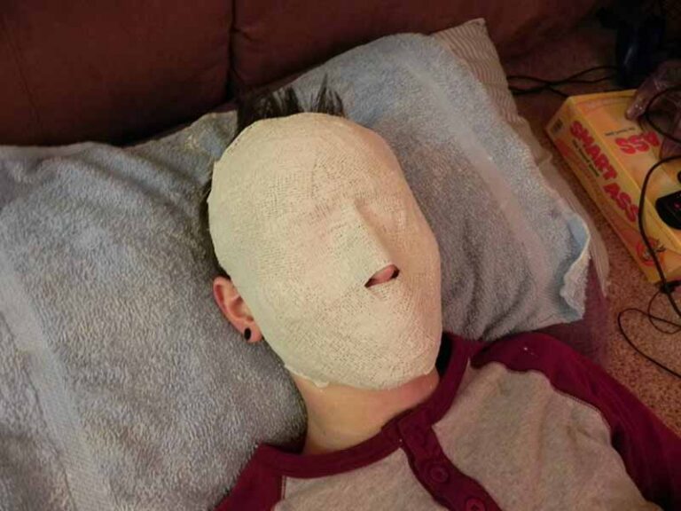 The plaster bandages creating a face cast.